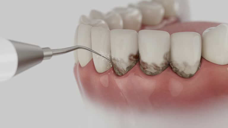 Trusted Emergency Dentist service in Kingwood, WV - Dentist Open Now